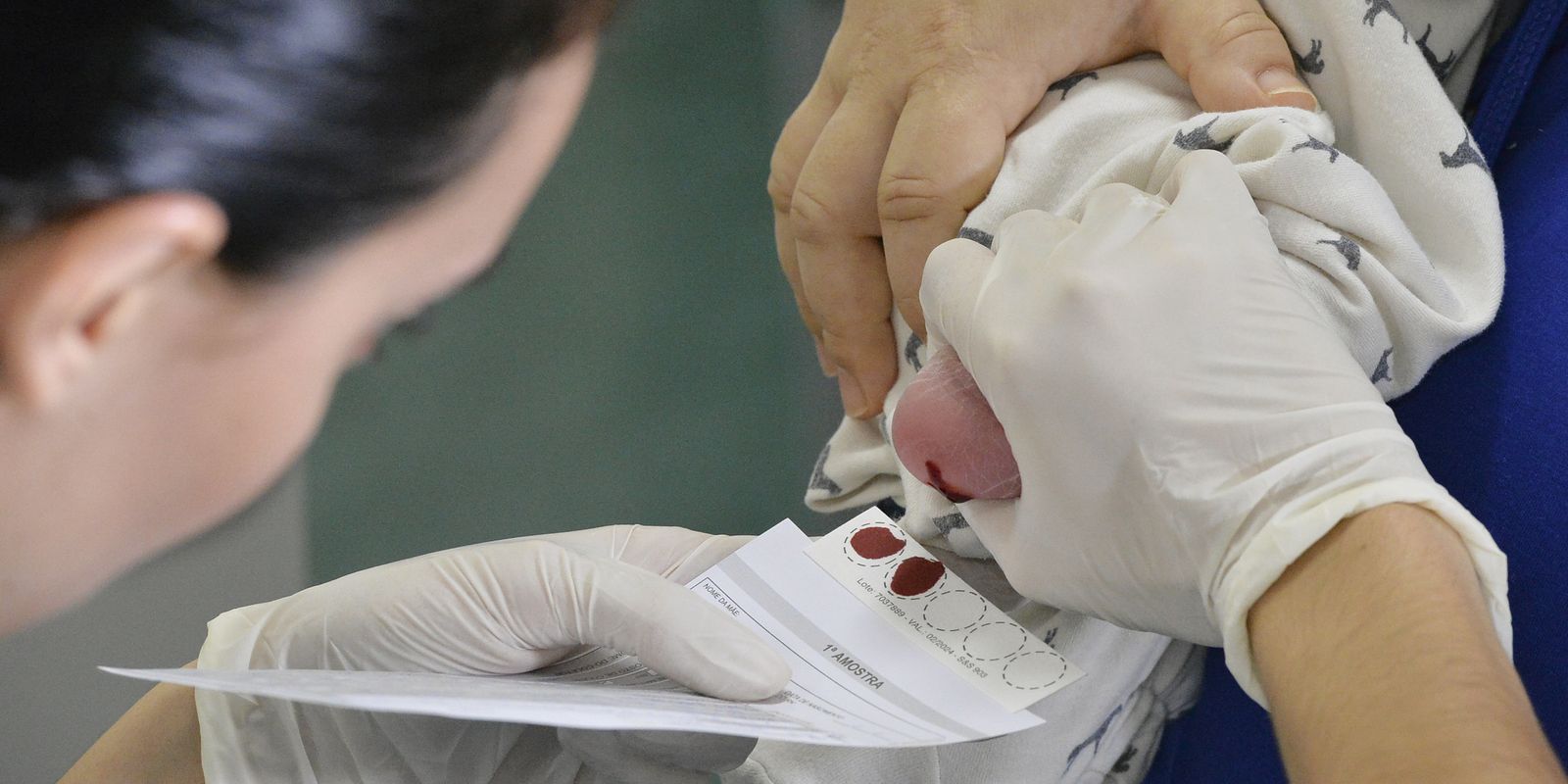 Saúde aumenta em 30% recursos para teste do pezinho