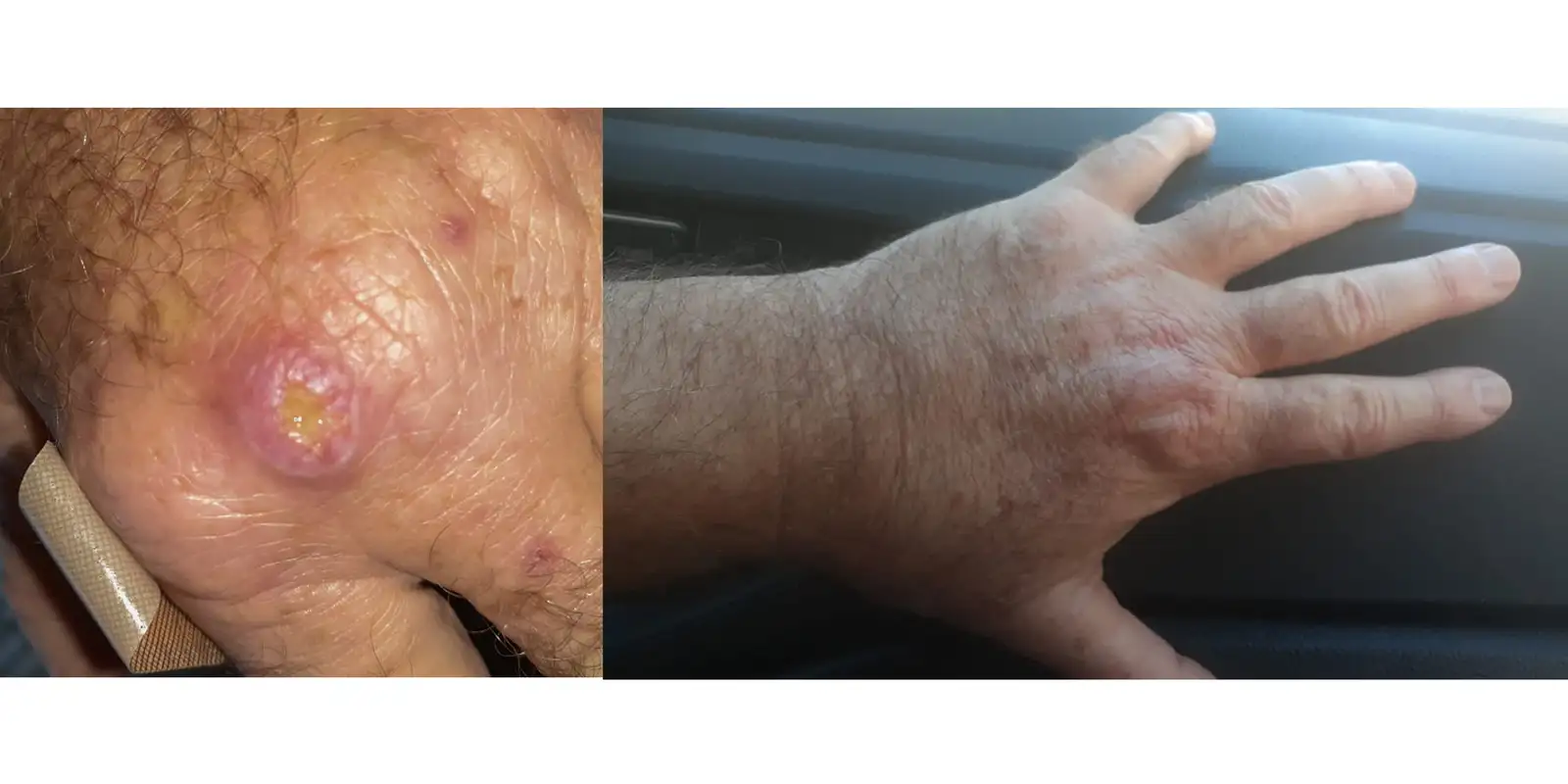 Especialistas alertam para a falta de informação sobre a leishmaniose Especialistas alertam para a falta de informação sobre a leishmaniose