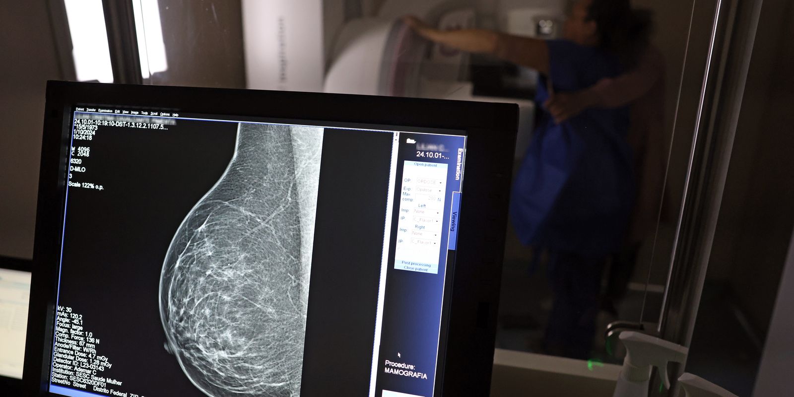 Falta de acesso a mamógrafos limita prevenção do câncer de mama