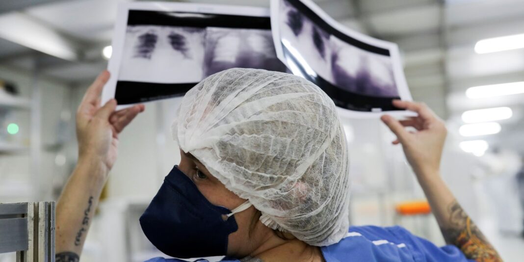 Diagnóstico tardio dá poucas chances de cura do câncer de pulmão